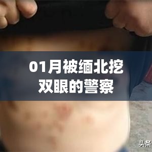 缅北警察遭遇暴力袭击，双眼被挖事件回顾