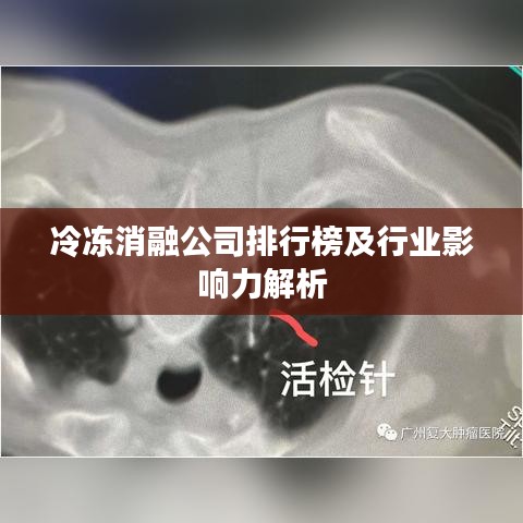 冷冻消融公司排行榜及行业影响力解析