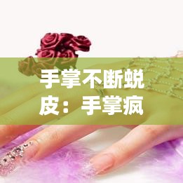 手掌不断蜕皮：手掌疯狂蜕皮 
