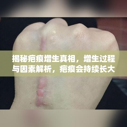 揭秘疤痕增生真相，增生过程与因素解析，疤痕会持续长大吗？