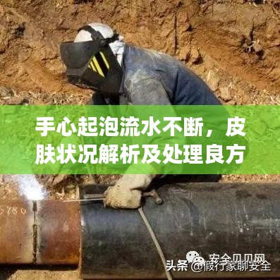 手心起泡流水不断，皮肤状况解析及处理良方
