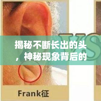 揭秘不断长出的头，神秘现象背后的医学探索之旅