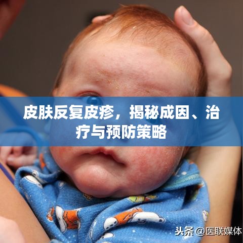 皮肤反复皮疹，揭秘成因、治疗与预防策略