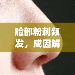 脸部粉刺频发，成因解析与防治管理策略