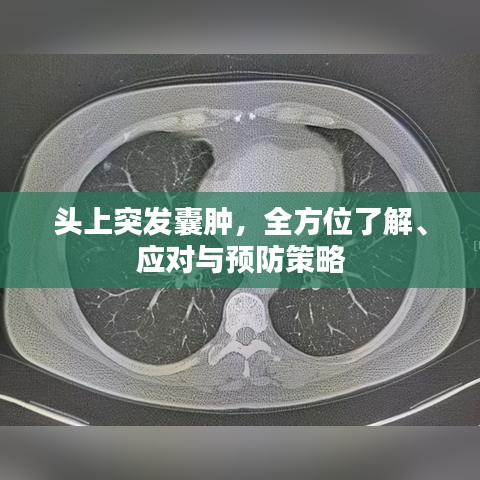 头上突发囊肿，全方位了解、应对与预防策略