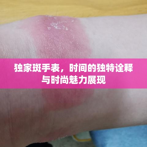 独家斑手表，时间的独特诠释与时尚魅力展现